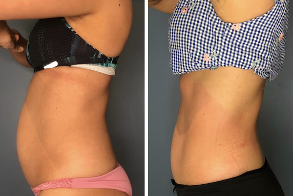 Foto 2 Dra Poliana Ruzza