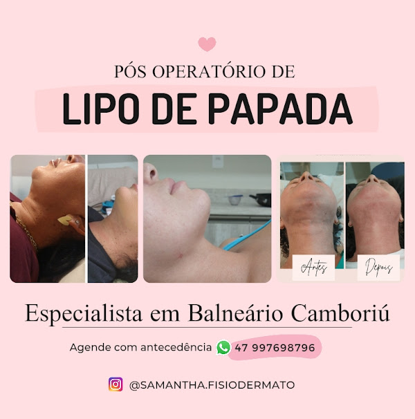 Foto 3 Pós Operatório - Samantha Gemellaro Foto 3 Pós Operatório - Samantha Gemellaro