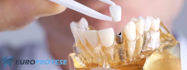 EUROPRÓTESE - Escola Técnica em Odontologia