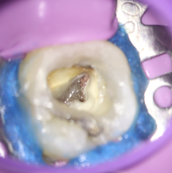 Foto 3 Dra Milena Perraro Martins Foto 3 Dra Milena Perraro Martins