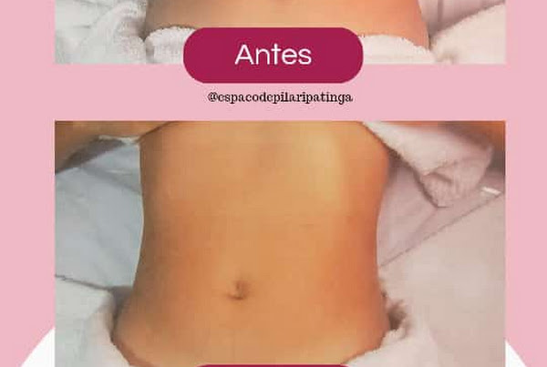Espaço Depilar Ipatinga