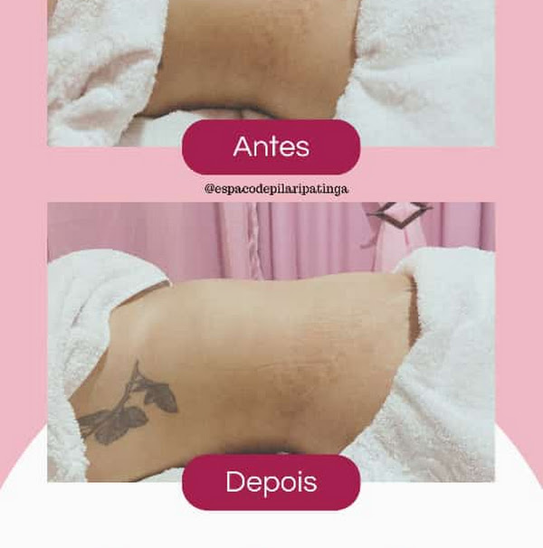Foto 1 Espaço Depilar Ipatinga Foto 1 Espaço Depilar Ipatinga