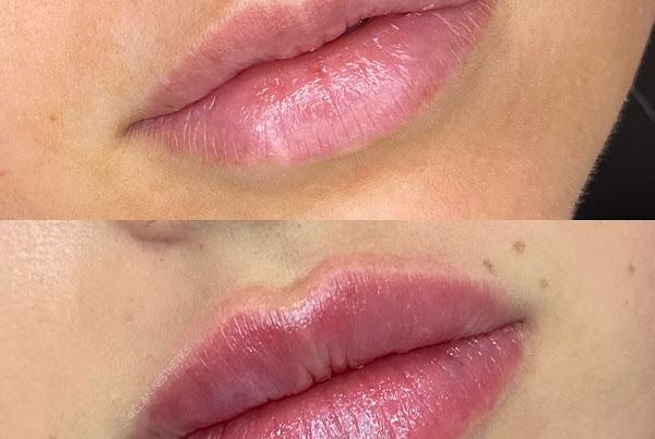 Dra. Mayra Valdier Dermatologista Muriaé