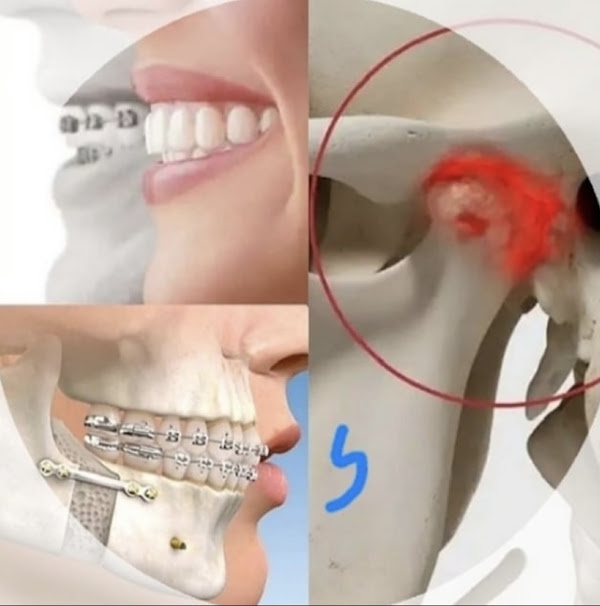 Foto 1 Dra.Simone Lacerda Goulart/odontologia do sono/DTM