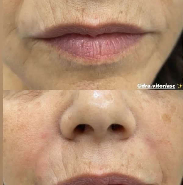 Foto 3 dra.vitoriasc Foto 3 dra.vitoriasc