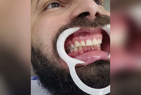 Foto 1 Vitalle Odontologia | Implante Dentário | Lentes de Contato Dental | Ortodontia - Gama, Brasília