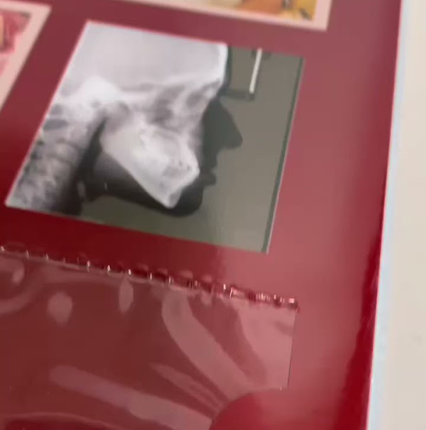 Foto 1 GRAFICA PLATEX Foto 1 GRAFICA PLATEX