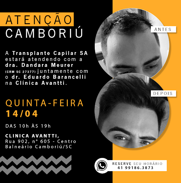 Foto 1 Barancelli Clínica Capilar