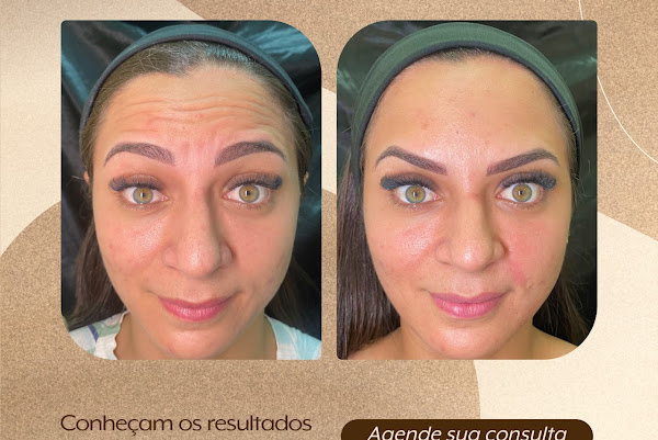 Foto 1 Clínica TS Estética