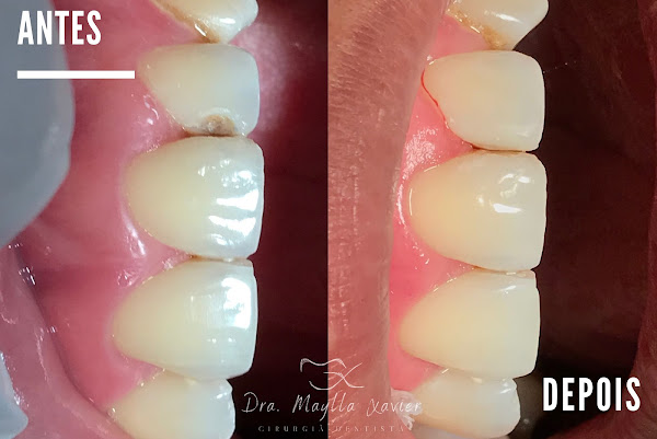 Foto 1 Dra.Maylla Xavier