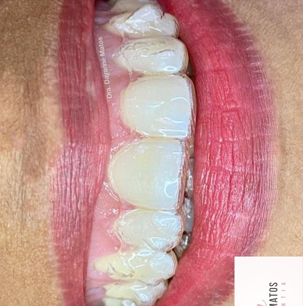 Foto 2 Dra. Dayanne Matos - Invisalign em Bacabal